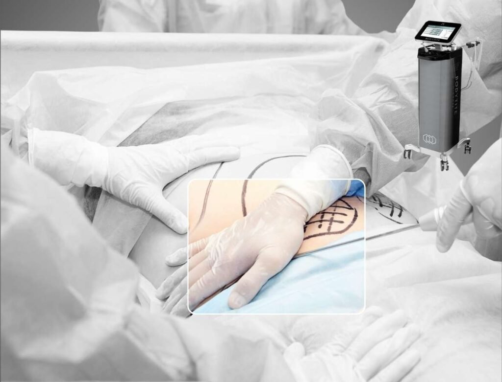 Bodytite en Bogotá con el Dr. Óscar Barón -