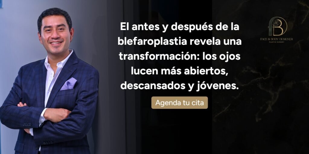 Blefaroplastia antes y después-Dr. Oscar Barón