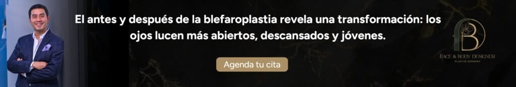 Blefaroplastia antes y después-Dr. Oscar Barón
