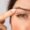 Blefaroplastia recuperación-Dr. Oscar Barón