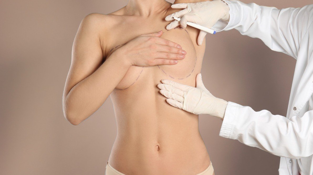 Explantación mamaria precio-Dr. Oscar Barón