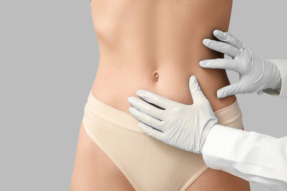 Tummy tuck near me- Dr. Oscar Barón