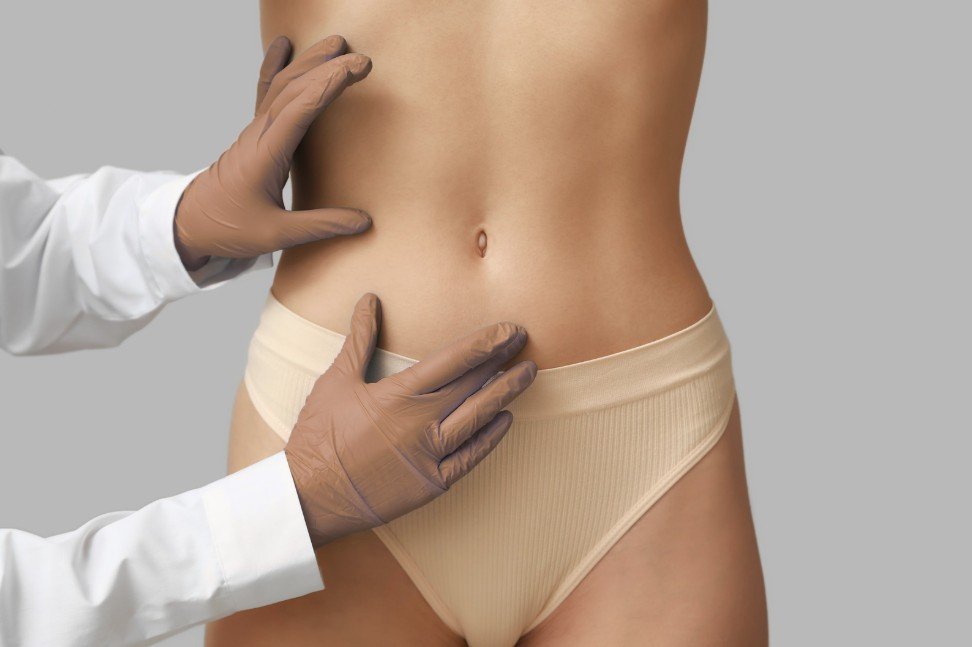 Liposucción Madrid o en Bogotá - Cirujano plástico Óscar Barón 2