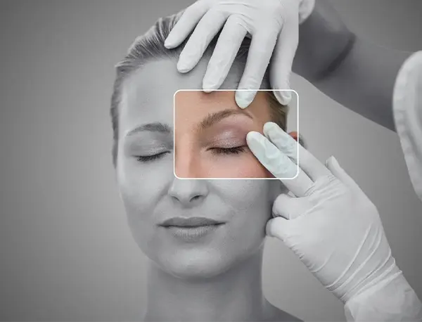 Img-cirujano-plastico-en-bogota-Procedimiento-Blefaroplastia