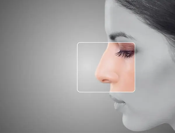 Img-cirujano-plastico-en-bogota-Procedimiento-Rinoplastia