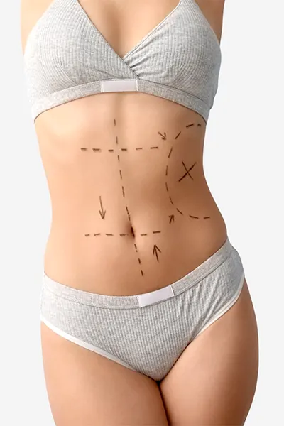 img-body-procedures-1-LCP