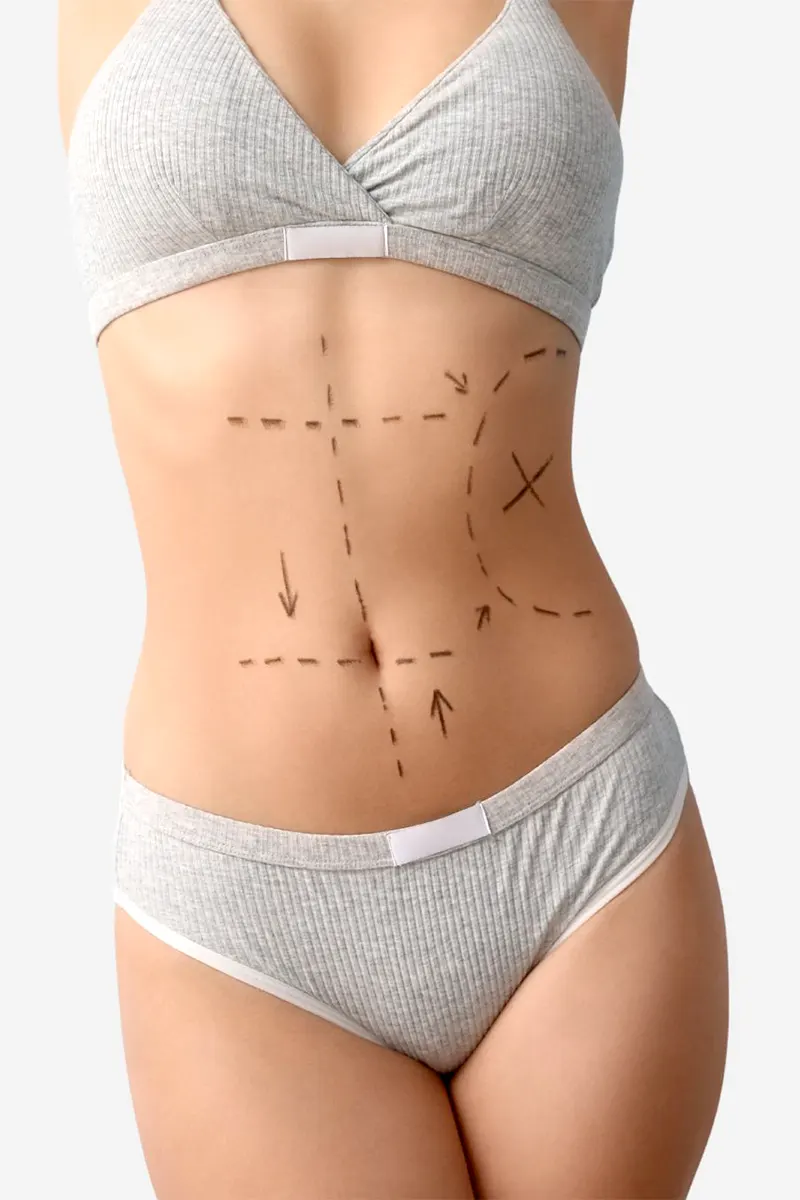 img-body-procedures-1