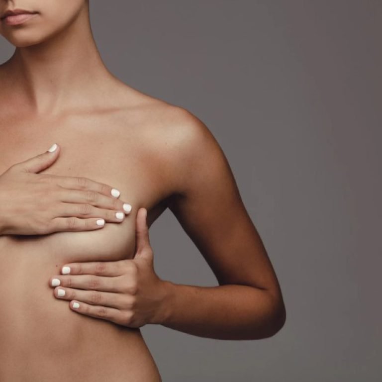 Explantación de mmas en Bogotá-Dr. Oscar Barón