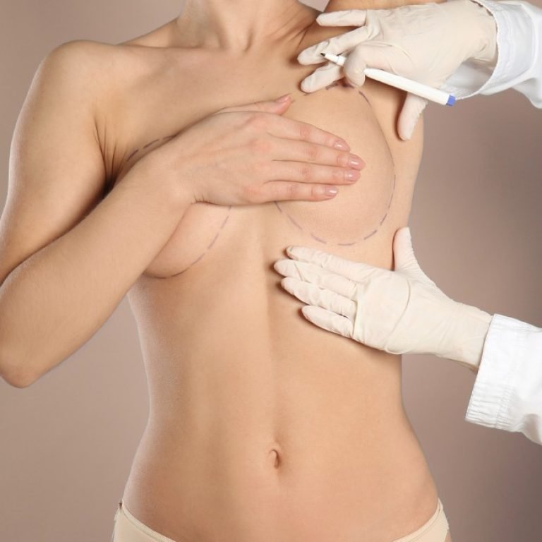 Explantación mamaria precio-Dr. Oscar Barón