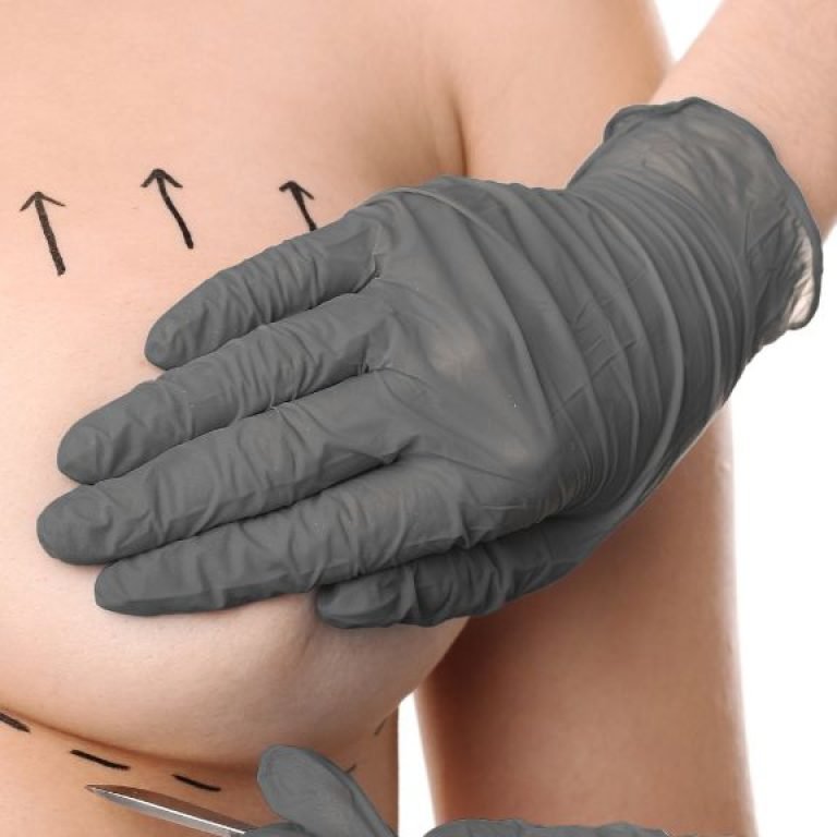 Mastopexia en Madrid o en Bogotá - Dr. Óscar Barón