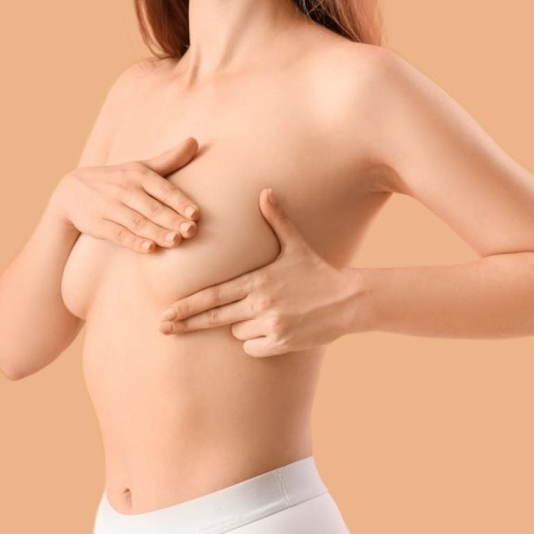 Mastopexia sin implantes precio - Cirujano plástico en Bogotá, Dr. Óscar Barón