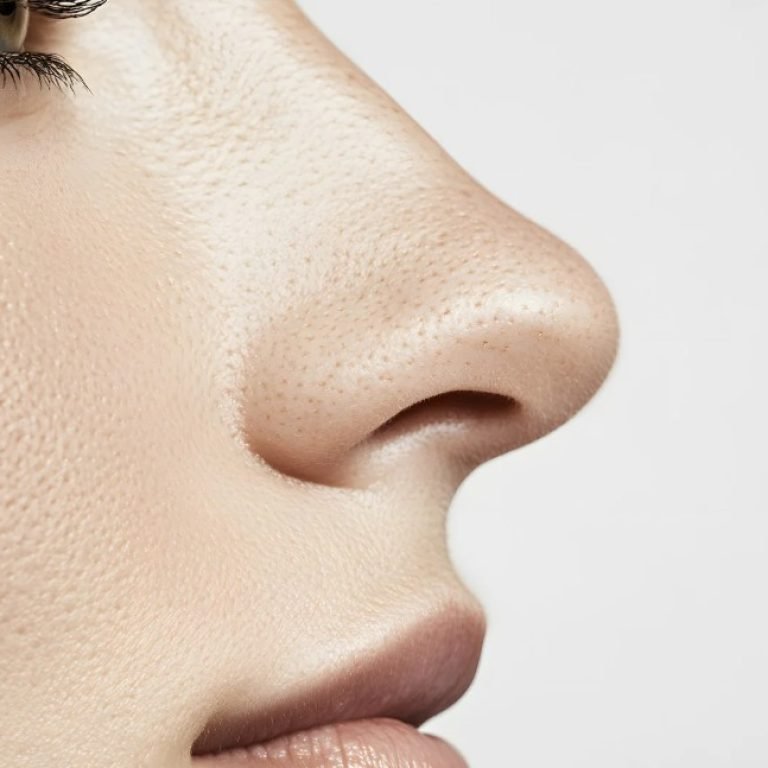 Rinoplastia ultasonipa para extranjeros-Dr. Oscar Barón