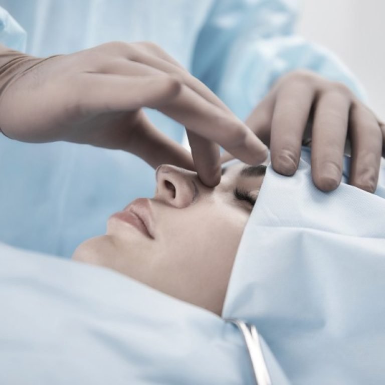 Rinoplastia ultrasonica-Dr. Óscar Barón