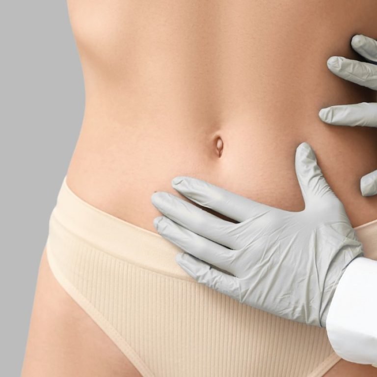 Tummy Tuck-Dr. Oscar Barón