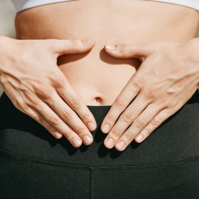 Tummy tuck antes y después fotos - Cirujano plástico en Bogotá Óscar Barón