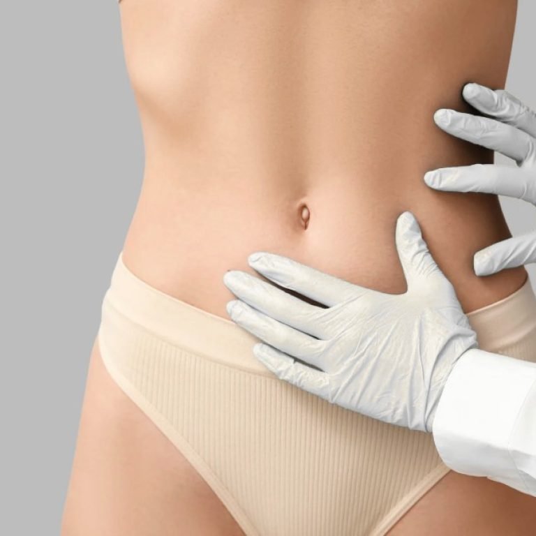 Tummy tuck near me- Dr. Oscar Barón