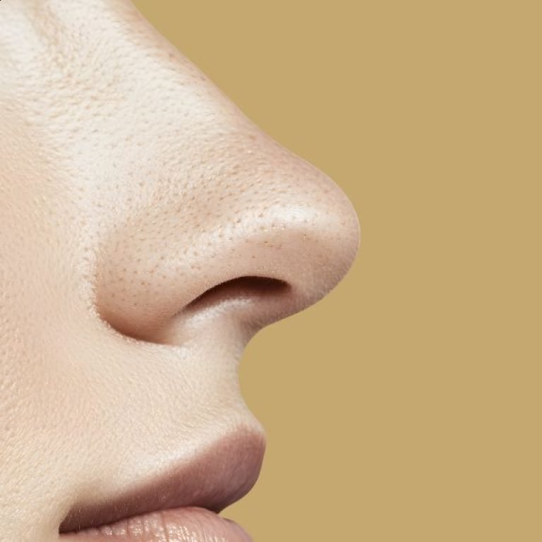 nose surgery in Colombia - Dr. Óscar Barón